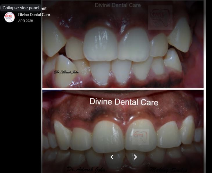 Dental Image